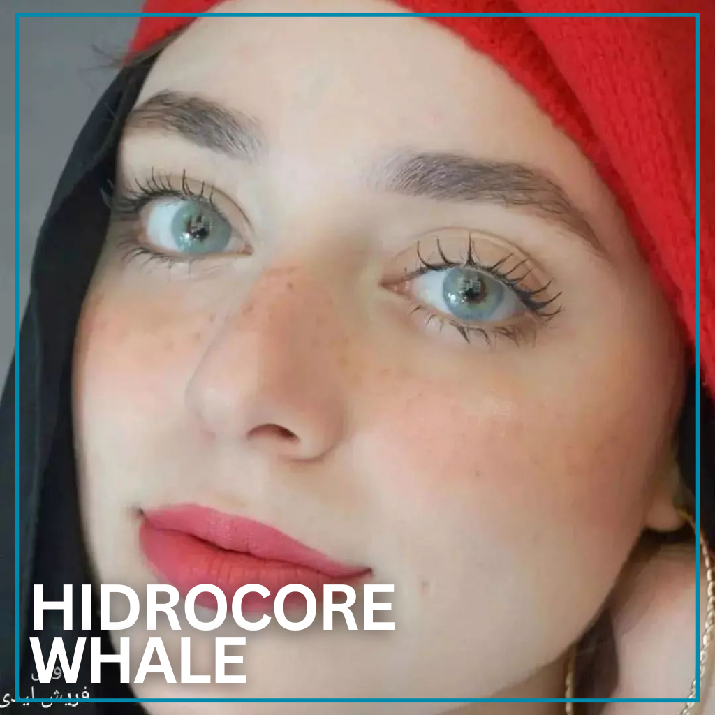 HIDROCORE WHALE